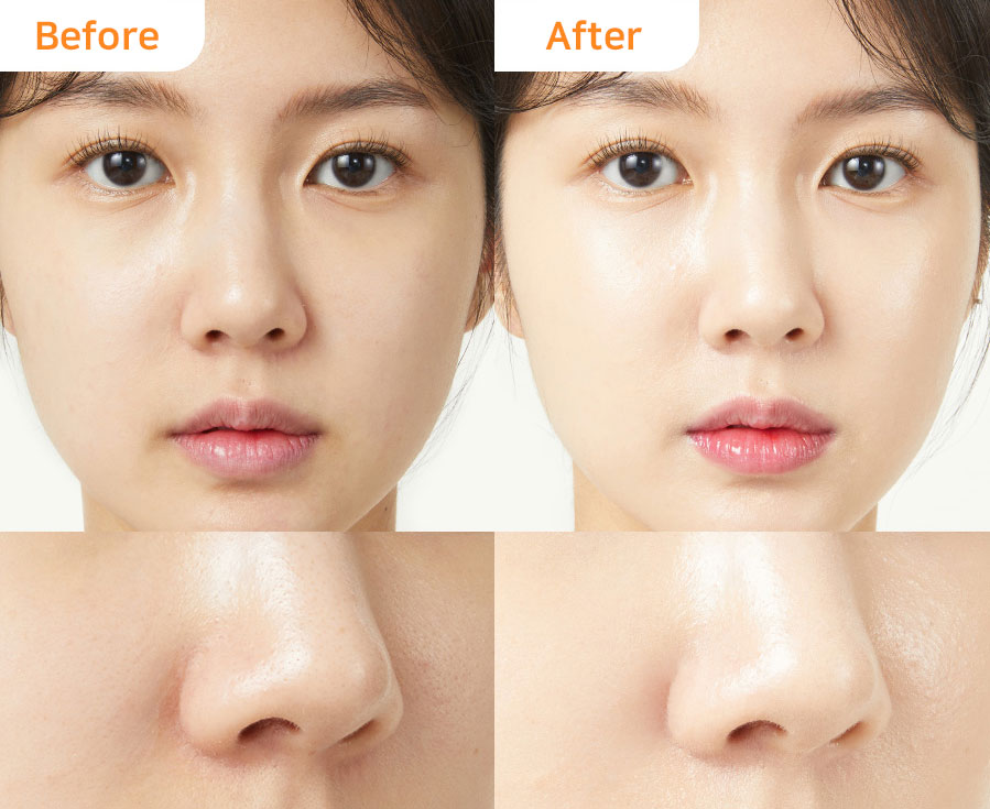 Dr.G | 韓国の人気コスメ・Dr.G お勧め化粧品 | 韓国化粧品オンライン